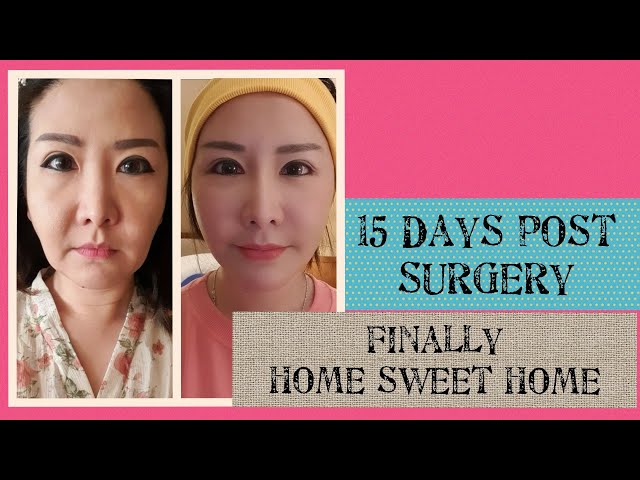 Update 15 Days post Surgery : OTW Home and Self Isolated | Olivia Rachelina Hans class=