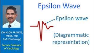 Epsilon Wave