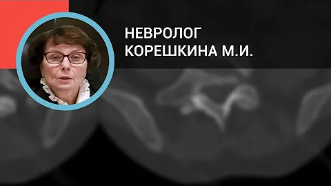 Невролог Корешкина М.И.: Боли в спине