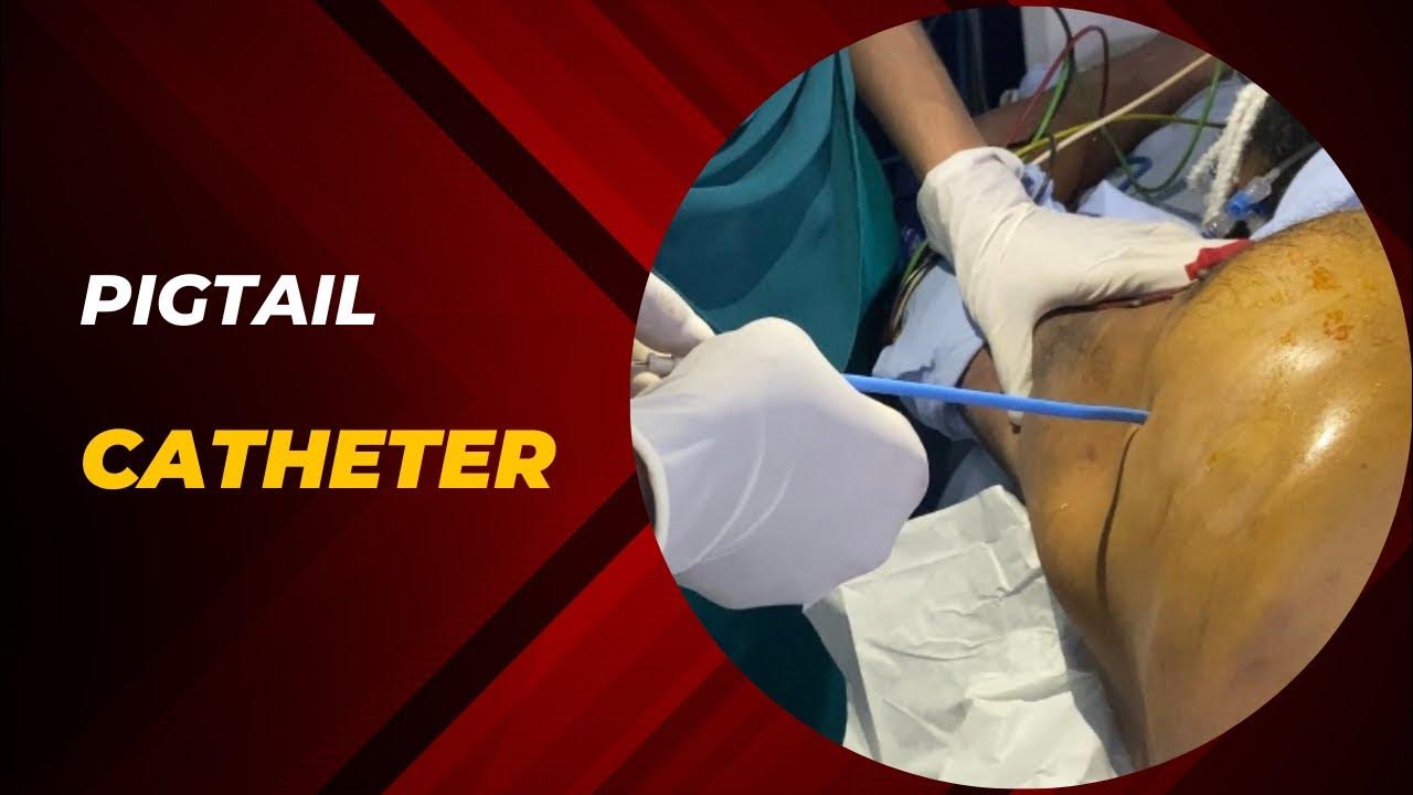 Pigtail catheter insertion, a smart procedure in ICU. YouTube