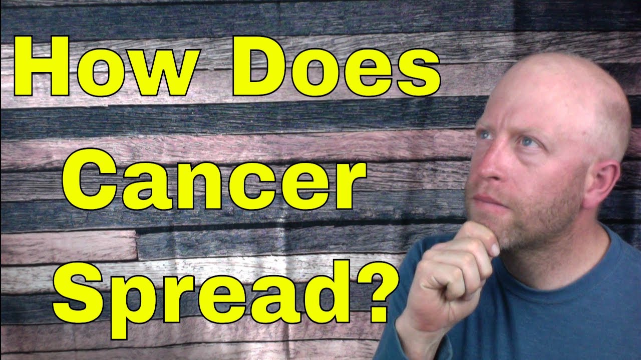 How does cancer spread? A Survivor's way of helping others understand