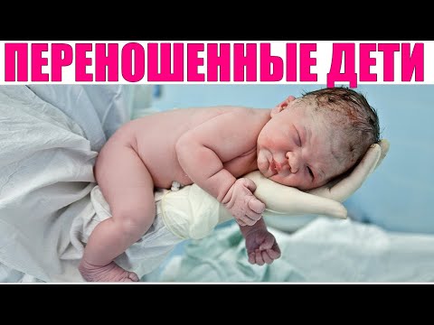 ПЕРЕНОШЕННАЯ БЕРЕМЕННОСТЬ | Чем опасно перехаживание для женщины и ребенка во время беременности