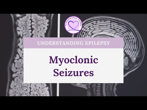 Video: Ar miokloninė epilepsija yra negalia?