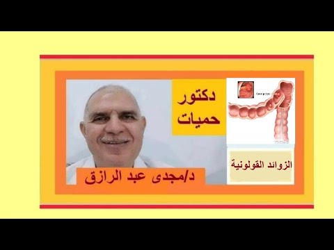 الزوائد القولونيه أعراضها وخطورتها COLORECTAL POLYPS