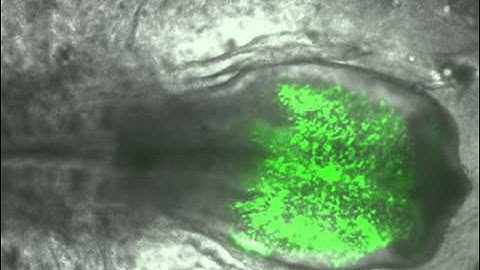Neural Crest Cell Migration in a Chicken Embryo