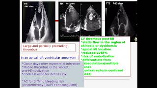 ECHO CASE STUDY