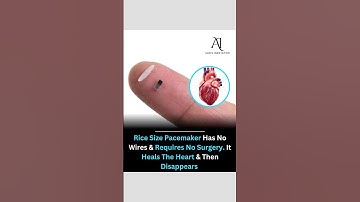 Revolutionary Rice-Sized Pacemaker: No Surgery, No Wires, Just Healing #health #heart #innovation