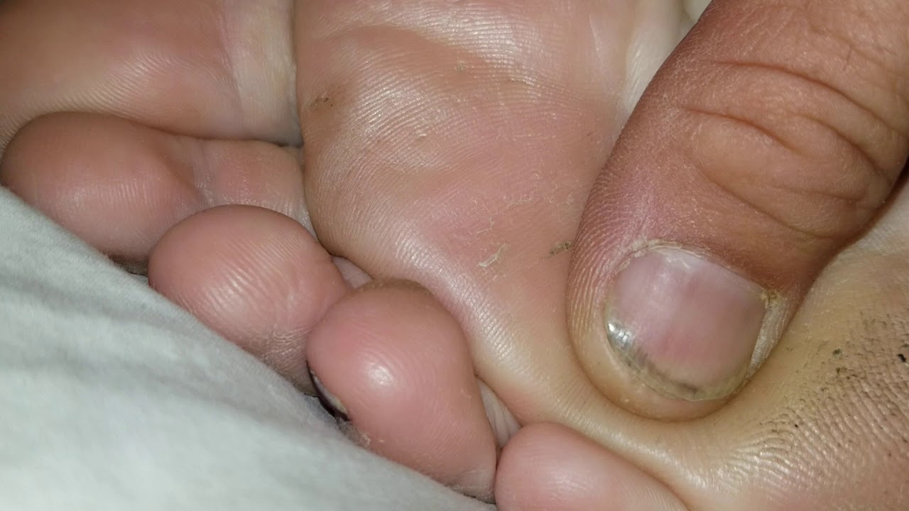 rubbing my sweet wifes feet while sle photo