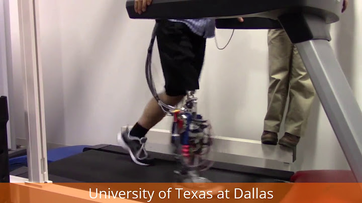 Amputee Fast Walking up to 3.0 mph on the UTD Powered Prosthetic Leg