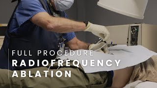 Radiofrequency Ablation Full Procedure - Lumbar
