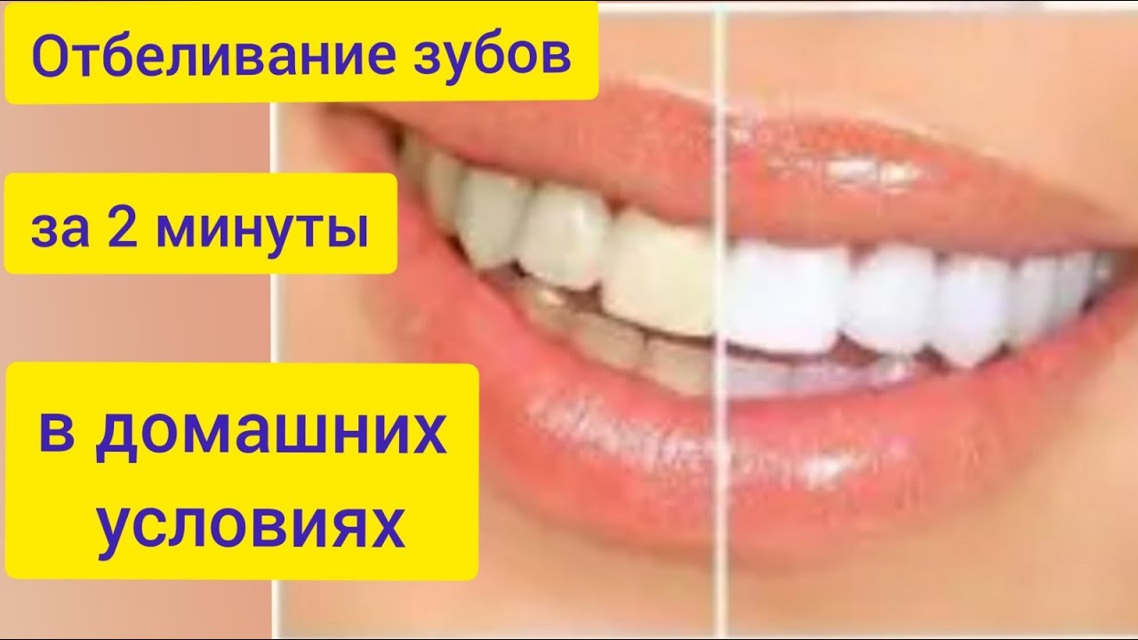 Эффективное отбеливание в домашних условиях. Отбеливание зубов за 2 минуты. Как отбелить зубы в домашних условиях. Желтые зубы как отбелить. Как отбелить зубы в домашних условиях за 5 минут.