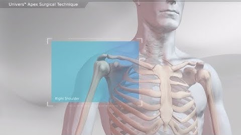 Univers™ Apex Surgical Technique