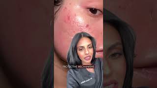 Dermaplaning Gone Wrong! - Doctor Reacts #skincareroutine #doctor #reaction #shortvideo