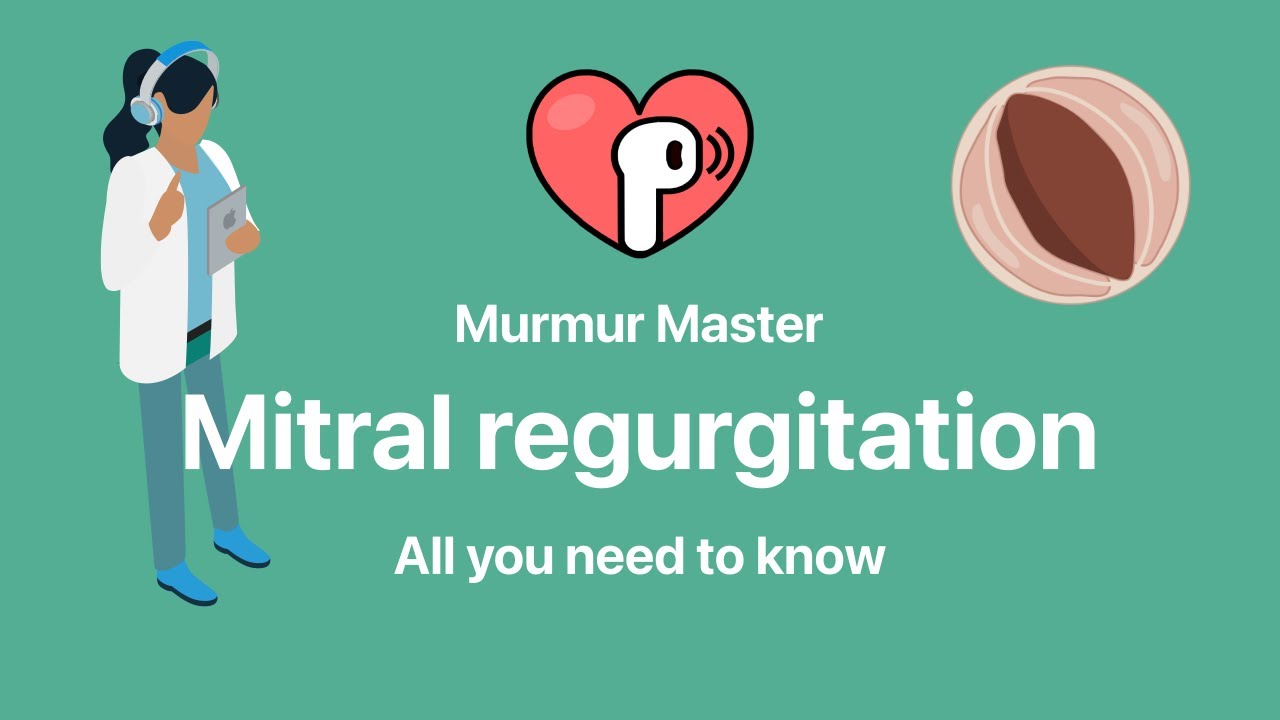 Mitral regurgitation in 2026: all you need to know (with murmur)