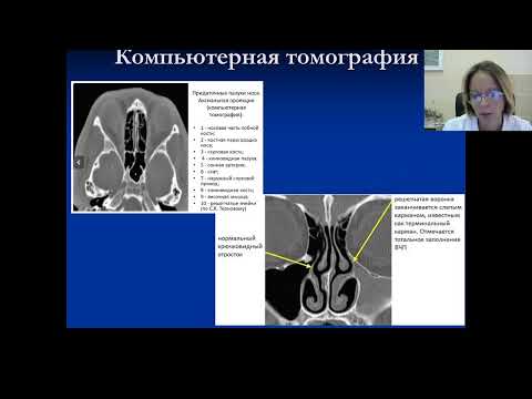 13/09//2022 Анатомия и физиология носа и околоносовых пазух