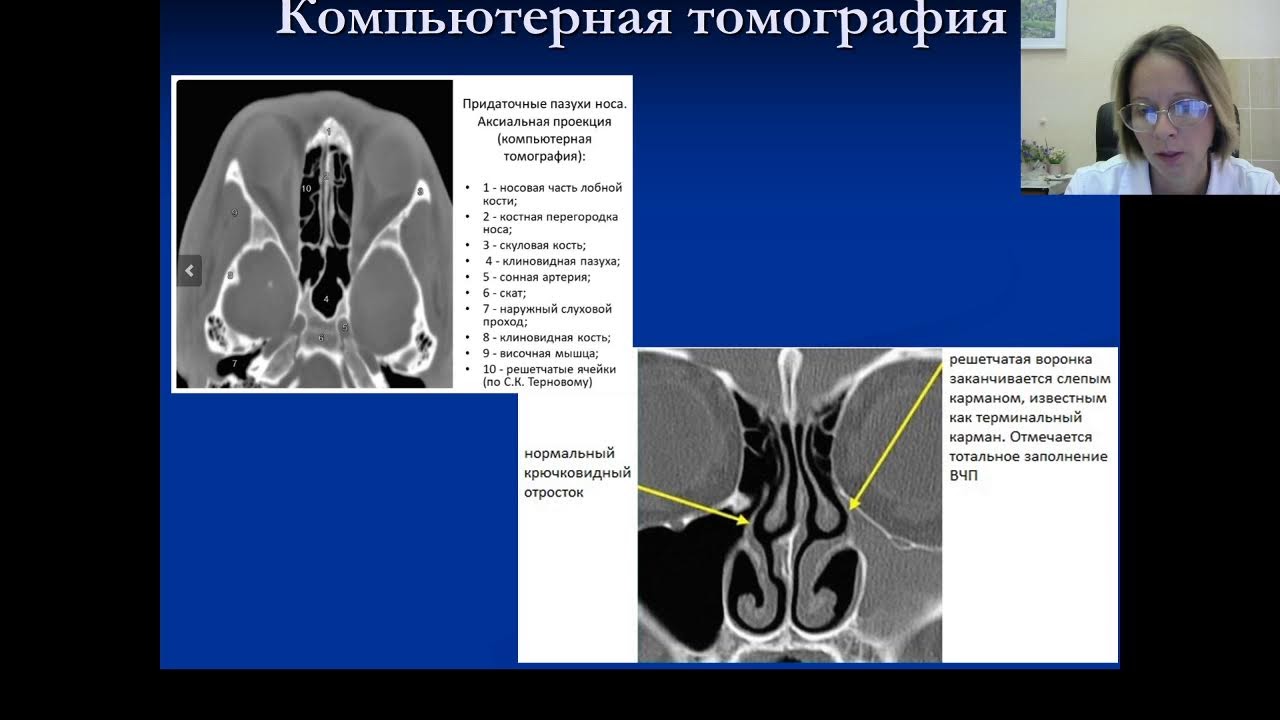 13/09//2022 Анатомия и физиология носа и околоносовых пазух - YouTube