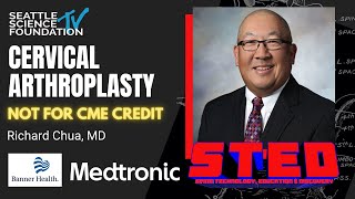 Cervical Arthroplasty - Richard Chua, MD
