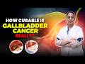 Gallbladder Cancer: Can It Be Completely Cured? | क्या गॉलब्लैडर कैंसर का पूरा इलाज संभव है? #cancer