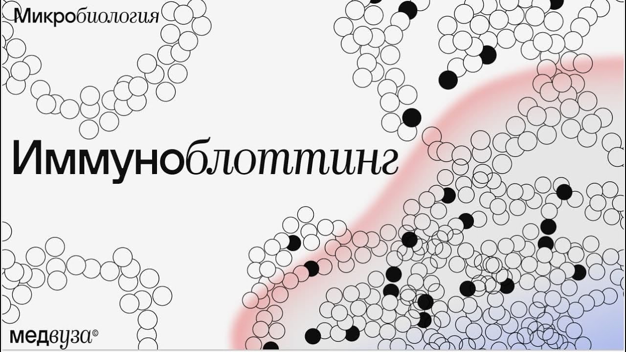 Иммуноблоттинг: компоненты и механизм метода | Микробиология - YouTube