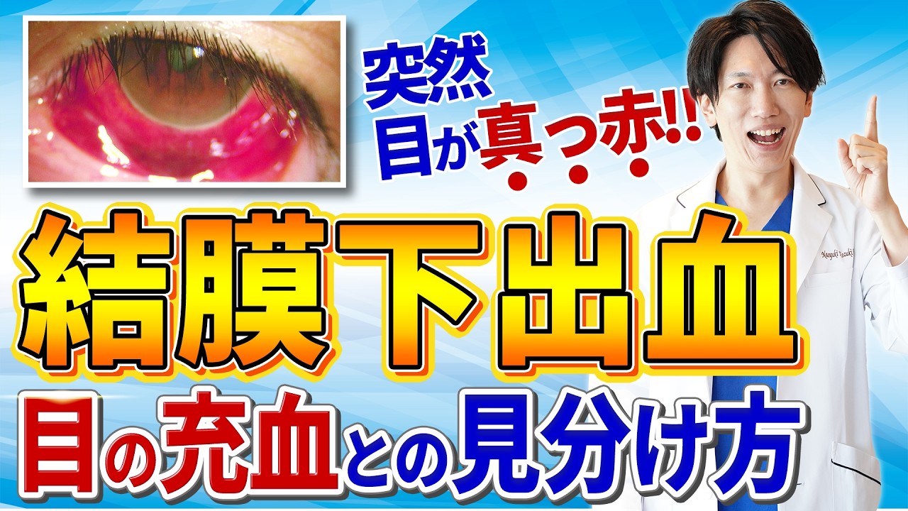 結膜下出血の原因と対処法|自然に治る病気?それとも危険なサイン?最新の眼科医が詳しく解説 - YouTube