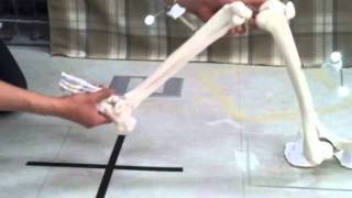Surgical Navigation For Total Knee Replacement