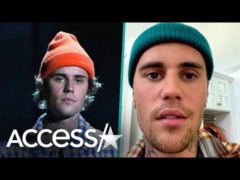 Justin Bieber Has Facial Paralysis After Ramsay Hunt Syndrome Diagnosis