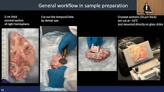 Ccmb Seminar 09252025 - Yang Xiao, Phd