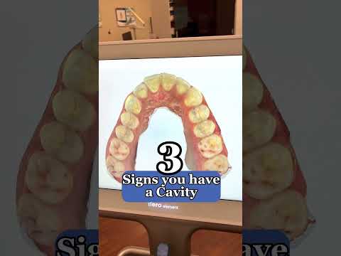 Video: 3 Ways to Clean Nicotine-Stained Teeth