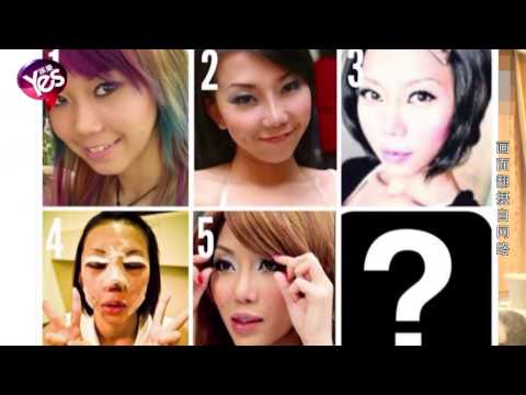 【5年前】F級辣模自曝十年整形路 腫臉血腥疑拆彈