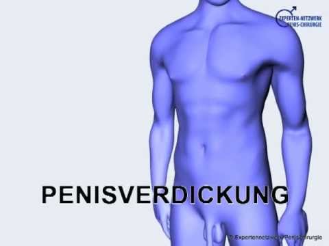 intimchirurgie penisvergroesserung penis verdickung intimchirurgie penisvergroesserung penis verdickung