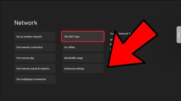 How to LOWER PING and BOOST INTERNET SPEED on XBOX (100% WORKING)