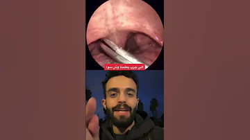 Fish Bone شوكة السمكة 