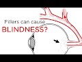 FILLERS CAN CAUSE BLINDNESS | Rare Complication | KNOW YOUR INJECTOR