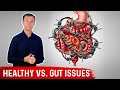 Fat-to-Protein Ratio on Keto: Healthy vs. Gut Issues