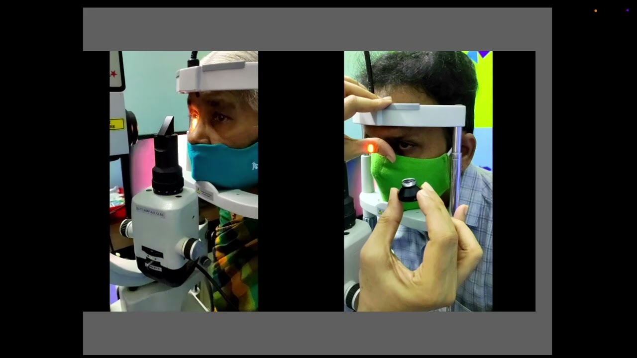 KSOS 2025  IC81  T Dr Sathyan P  Lasers for angle closure glaucoma – laser iridotomy and iridoplasty