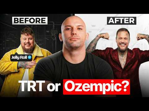 Jelly Roll’s 300 LB Transformation Exposed Everything Wrong with the Fitness Industry