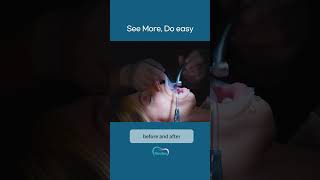 Environment before and after using Hippo-U and Hippo-D