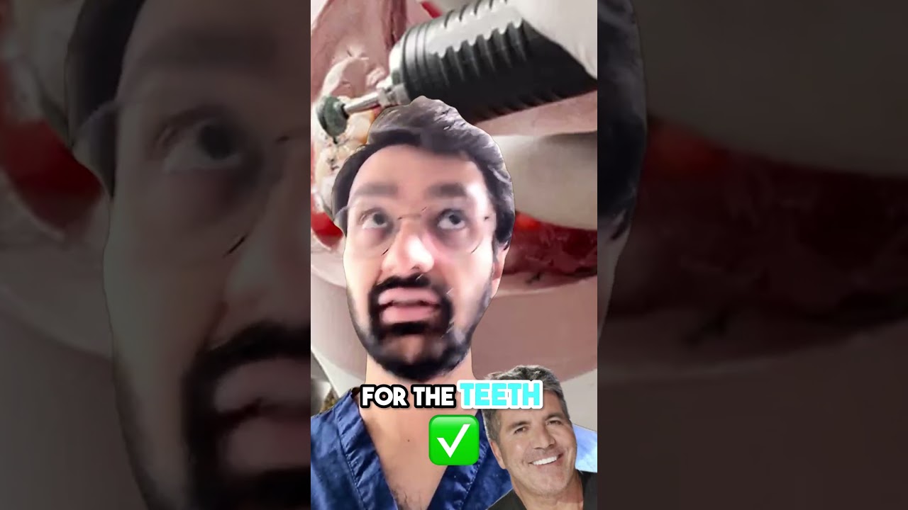 Dentist Video Ad #alexhormozi #editing #videoediting #video #freelancing  #viral #trending
