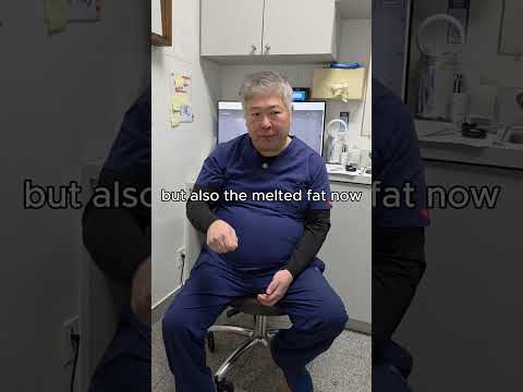 Endolift Assisted LIPO Vs LIPO 