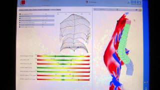 Download Lagu Scoliosis Systems LLP 2014 MP3