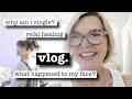 My Thoughts on Being Single, What Happened to My Face? Over 50 Vlog