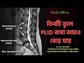 Plid 22    plid      3 mistakes more plid pain  doctor shah alam