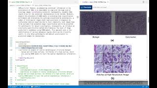i-LaTeX: Manipulating Transitional Representations between LaTeX Code and Generated Documents