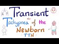 Transient tachypnea of the newborn ttn  pediatrics  5minute review