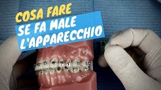 Fa male l&#39;apparecchio? Ecco cosa fare!