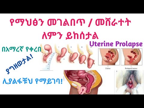 ቪዲዮ: ዘንግ እና ብቸኛ ኃይሎች