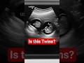 4 Weeks Pregnant | Baby Development Inside the Womb (Fetus at 1 Month)