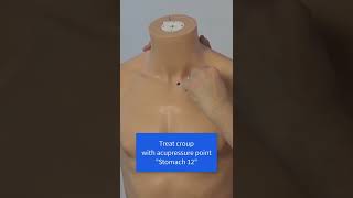 #croup - Acupressure in 60 Seconds