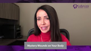Mystery Wounds On Your Body - Dr Violet Newman - Lakeview Dental Centre Calgary