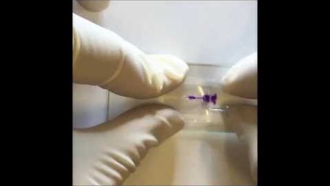 A one-step strategy for ultra-fast and low-cost mass production of plastic membrane microfluidic ...